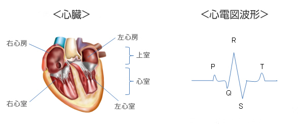 電気刺激電動路の絵、心電図波形