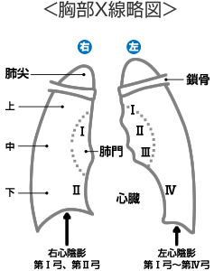 胸部X線略図