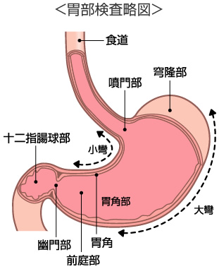 胃部検査略図